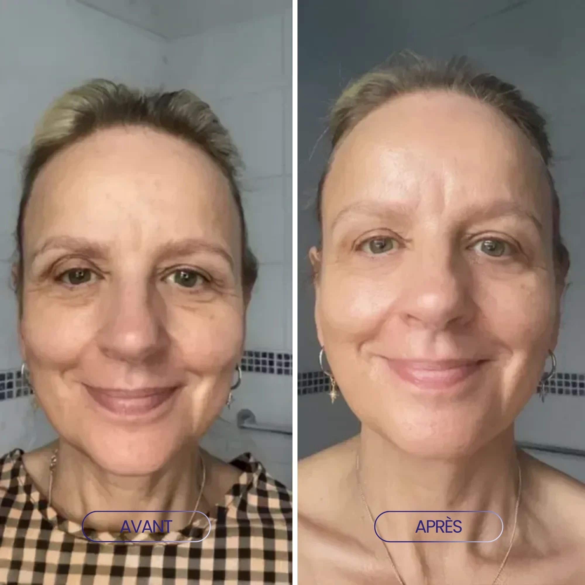 BROSSE DE DRAINAGE LYMPATHIQUE